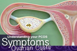 1900 symptoms ovarian cysts head