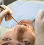 سرطان دهان : علل و علائم و پیشگیری و درمان
