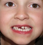 راهکارهای مراقبت از دندان های شیری کودکان